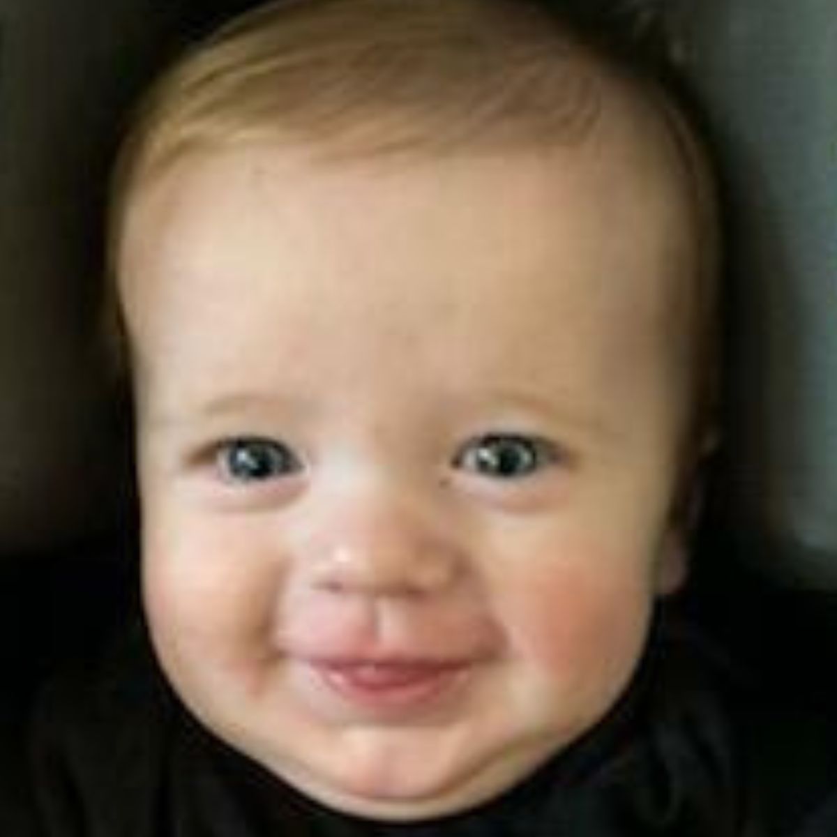 Baby with cleared cradle cap and rashes