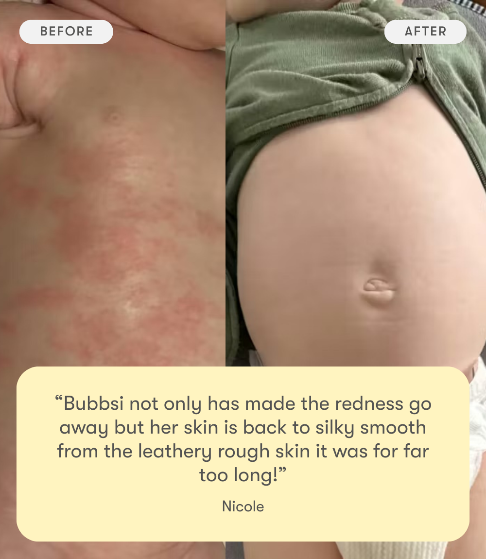 dry skin & scalp starter set