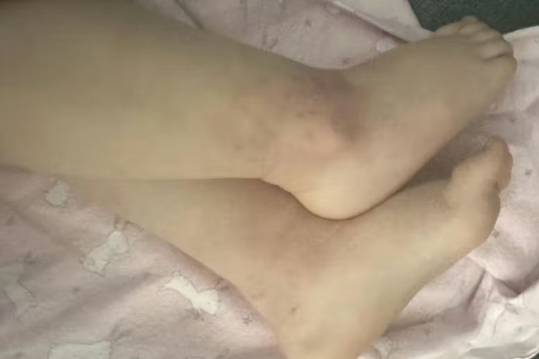 Close-up of a person's feet on a patterned surface