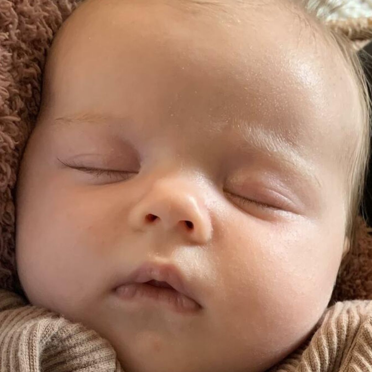 Close-up of a sleeping baby's face with a soft focus on the eyes. Skin cleared from eczema and baby acne