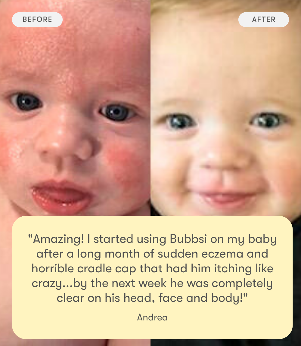 dry skin & scalp starter set