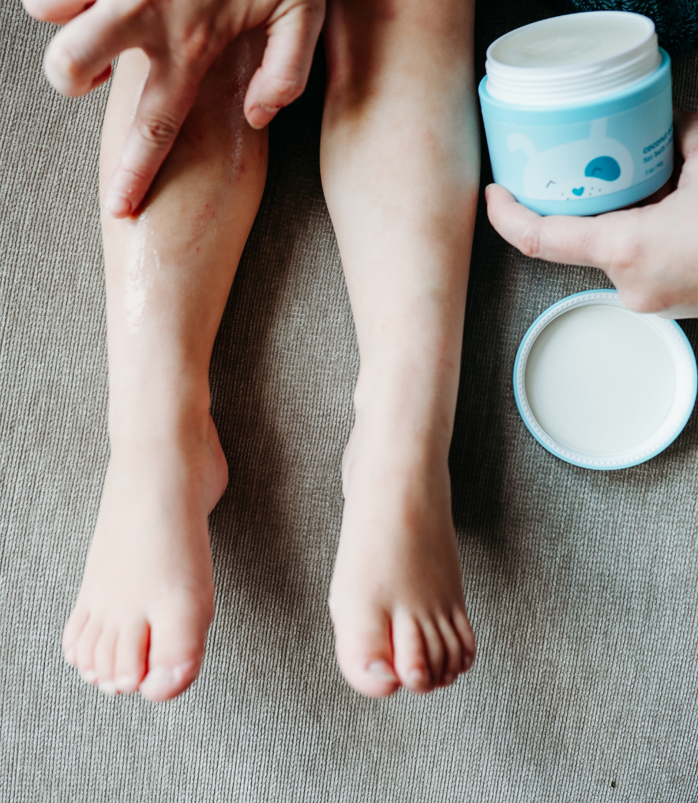 coconut oil balm