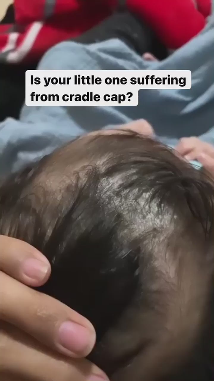 Meylin cradle cap reel.mov